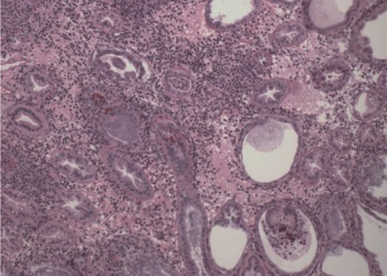Hội chứng phân trắng trên tôm: Dự báo mầm bệnh vi bào tử trùng EHP?